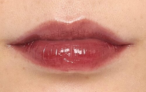 黄み肌 イメージ