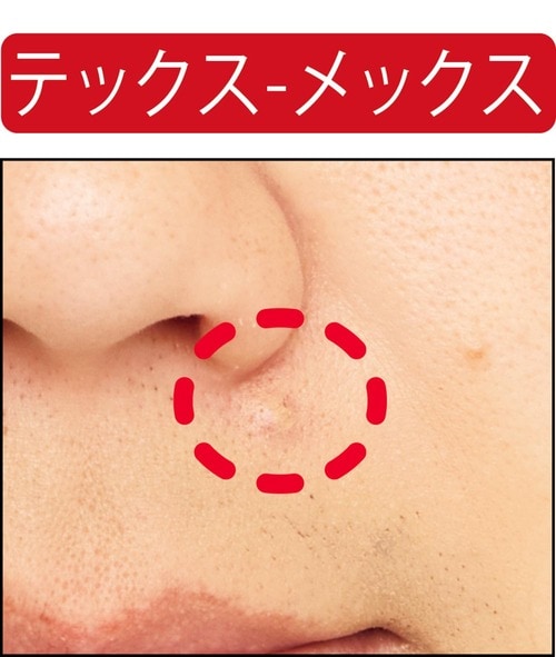 【ニキビ隠し】ニキビの赤みは抑えられた メンズコンシーラーおすすめ イメージ2