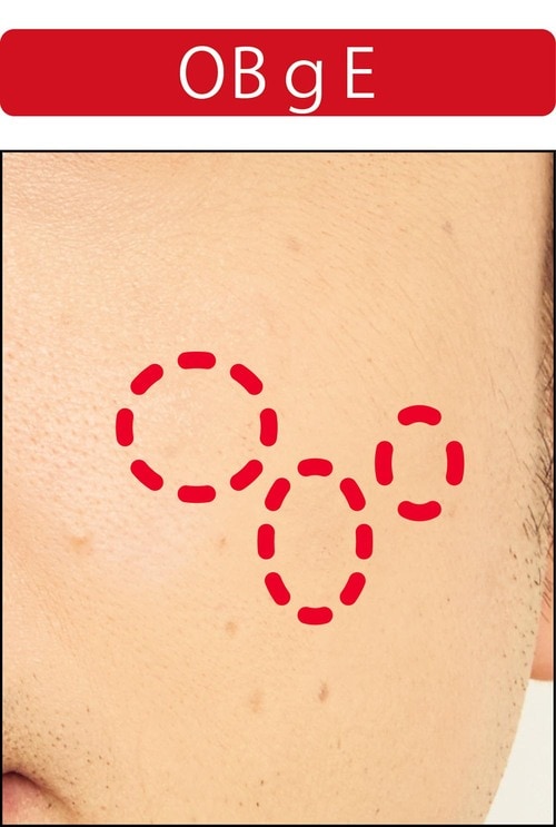 【シミ隠し】“塗った”感がなくナチュラルに補整できた! メンズコンシーラーおすすめ イメージ2