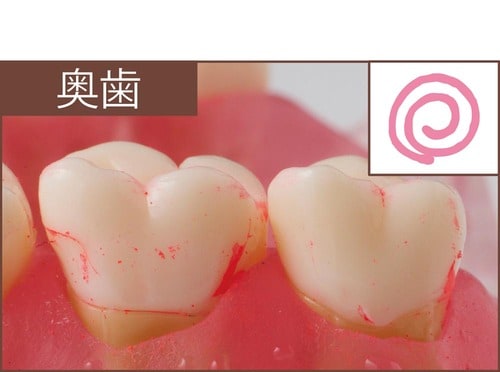 汚れ落ち：評価B イメージ
