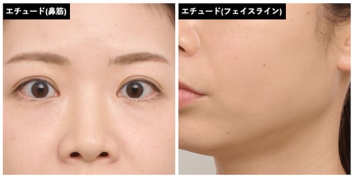 イエベ肌・ウォームメイクとの相性が良さそう シェーディングおすすめ イメージ