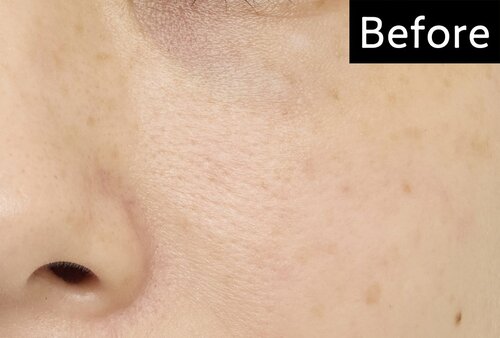 カバー力 BBクリームおすすめ イメージ