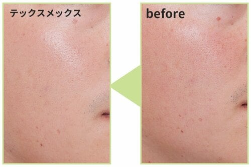 仕上がり メンズコンシーラーおすすめ イメージ