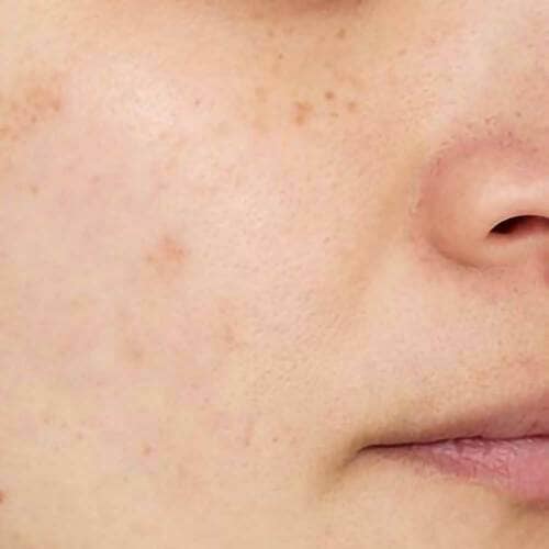 仕上がり：カバー力とナチュラルさを両立 インスタライブおすすめ イメージ