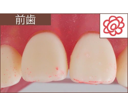 汚れ落ち：評価A+ イメージ