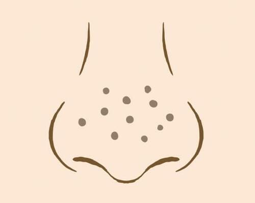 黒ずみ毛穴 ビタミンC美容液おすすめ イメージ